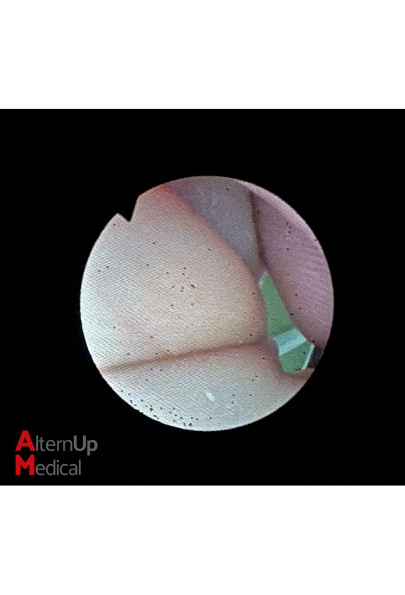 Gastroscope Fibroscope Olympus GIF-XQ10