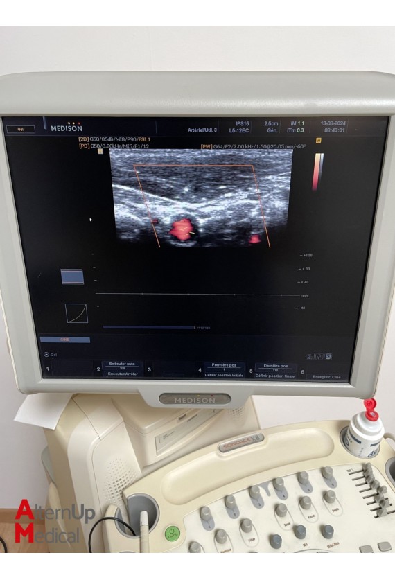 Medison Sonoace X8 Ultrasound System