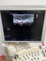 Medison Sonoace X8 Ultrasound System