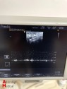 Medison Sonoace X8 Ultrasound System