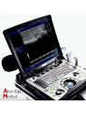 GE Logiq e Portable Ultrasound + 4 probes