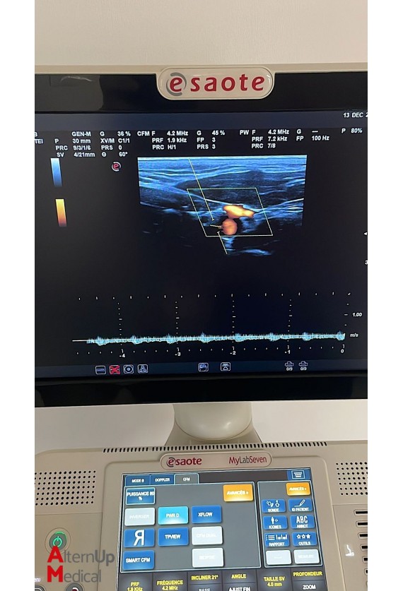 Echographe Esaote MyLab Seven eHD année 2017 avec 4 sondes (Specialité Cardiologie)