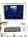 Kontron Sigma 5000 Imagic Elite Ultrasound with 3 probes