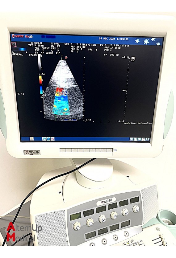 Echographe Esaote MyLab 60 Spécialité Cardiologie avec 3 sondes