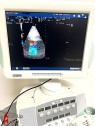 Esaote MyLab 60 Ultrasound Cardiology Specialty with 3 probes