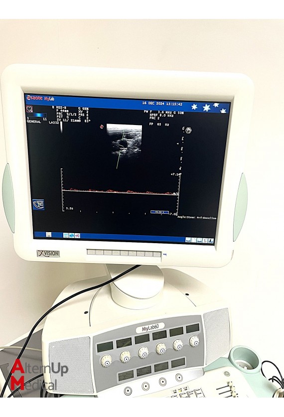 Echographe Esaote MyLab 60 Spécialité Cardiologie avec 3 sondes