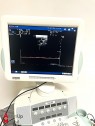 Esaote MyLab 60 Ultrasound Cardiology Specialty with 3 probes