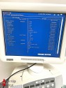 Esaote MyLab 60 Ultrasound Cardiology Specialty with 3 probes