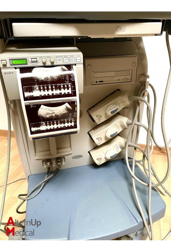 Toshiba Xario SSA-660A Ultrasound with 3 probes