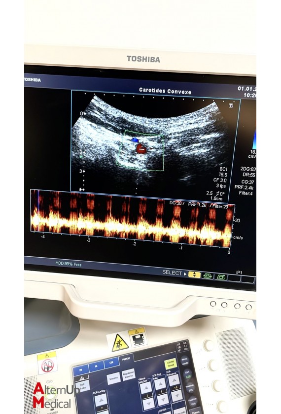 Echographe Toshiba Xario SSA-660A avec 3 sondes