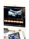 Toshiba Xario SSA-660A Ultrasound with 3 probes