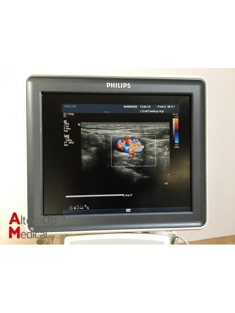 Echographe Philips iU22